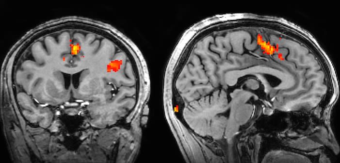 انجام پروژه FMRI